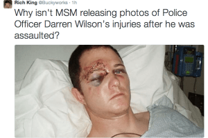 This is what Officer Wilson could have looked like if he had been hit hard with closed fists.