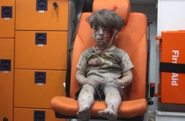 Omran Dagnees, a five year from Aleppo, Syria (getty images)